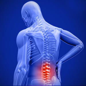 Teaching exercises for back pain and lumbar disc